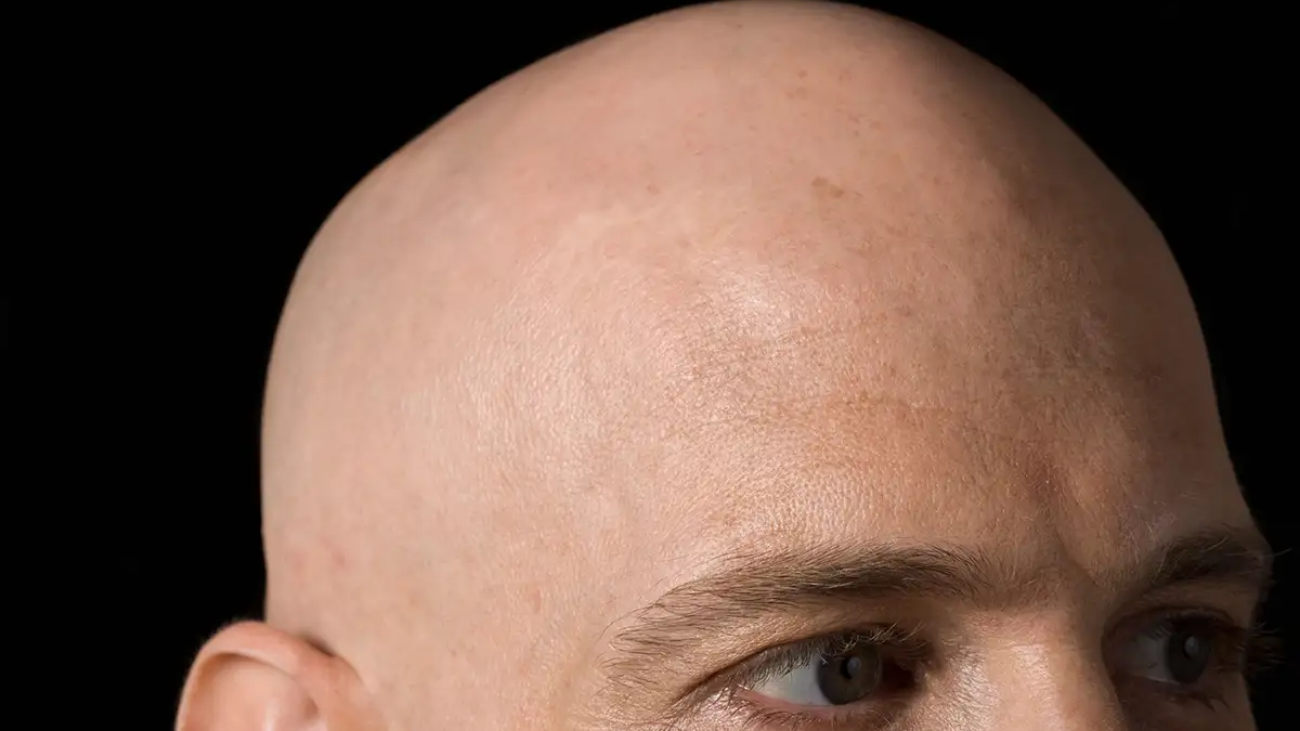 bald