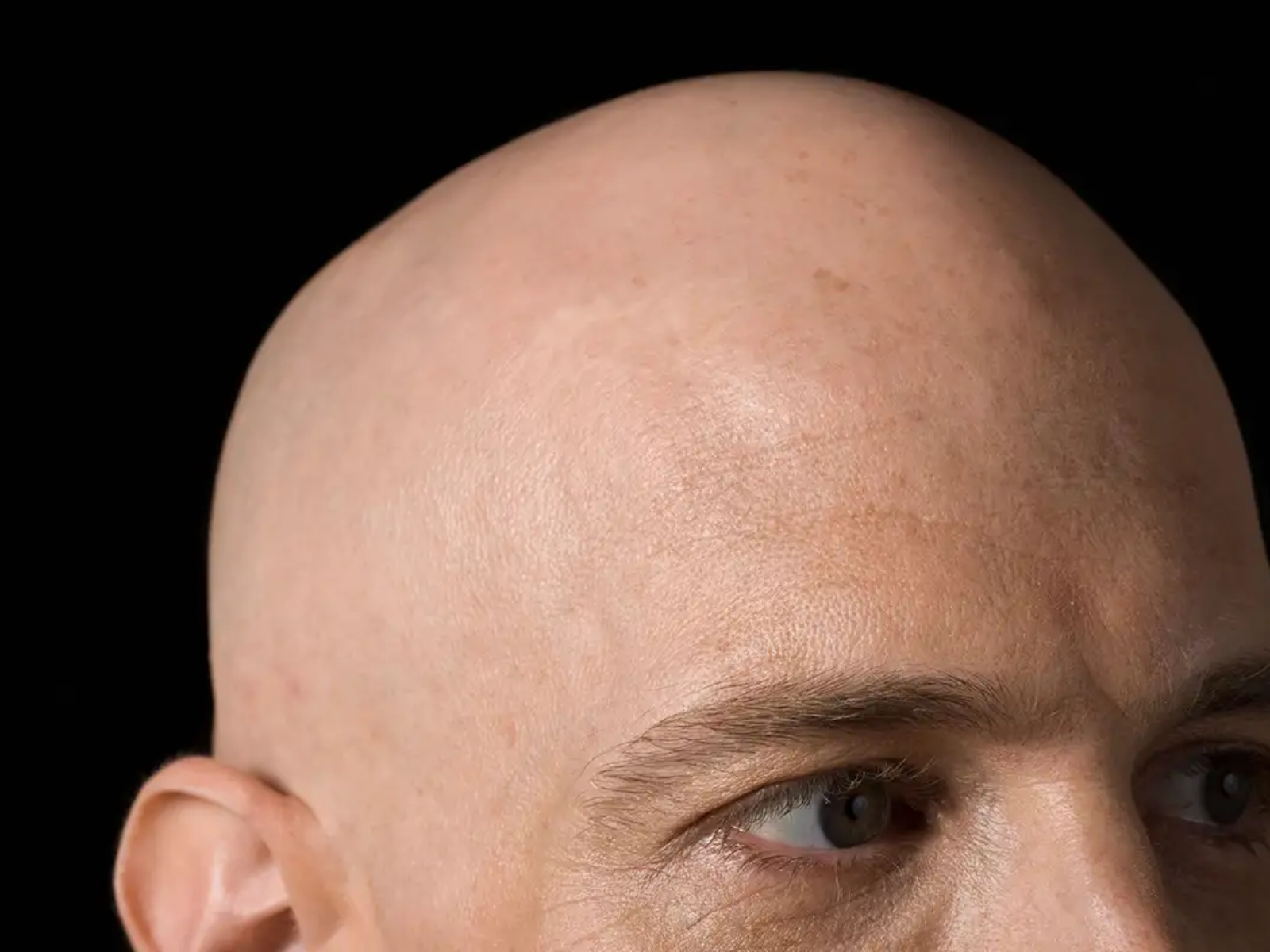 bald