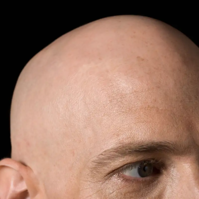 bald