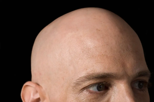 bald